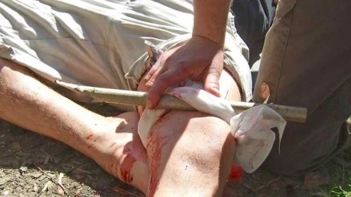 Vorschau Bild des Kurses Outdoor Erste Hilfe